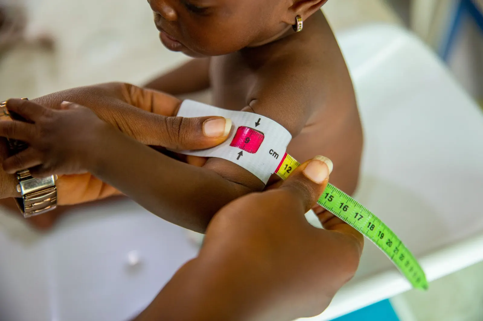 Health worker measuring a baby's upper arm with a child-growth tape during a check-up